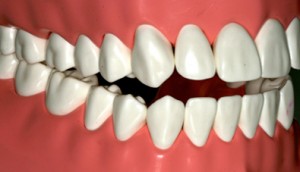 ortodoncia dental internacional
