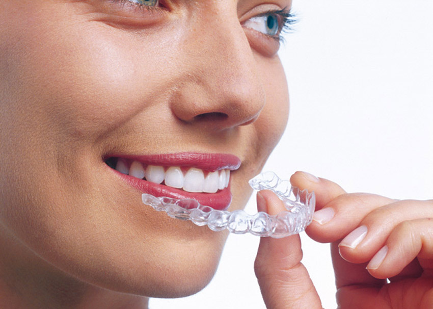 Invisalign: ¿Quieres hacerte la ortodoncia con el sistema invisible más cómodo?