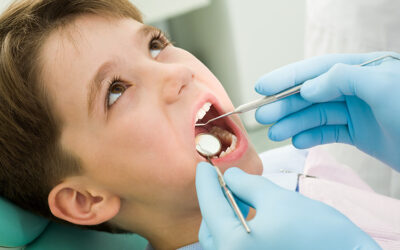 ¿Que son dientes supernumerarios?