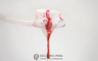¿Como sé si tengo Gingivitis o Periodontitis (Piorrea)?