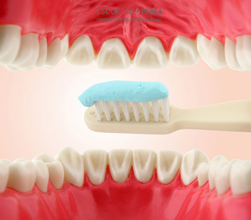 ¿Como se limpian los implantes dentales?