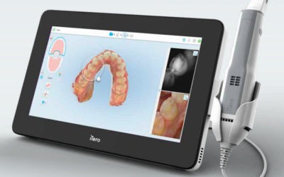 Que es un escaner intraoral?
