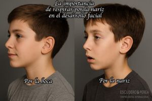 La importancia de respirar por la nariz en el desarrollo facial